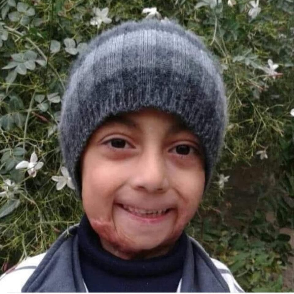 Mohammad Rashid Khalil, a 10-year-old boy with Down syndrome, was abducted with his father last week and was found dead on Monday in the Afrin countryside, Syria, May 27, 2019. (Photo: AMC)