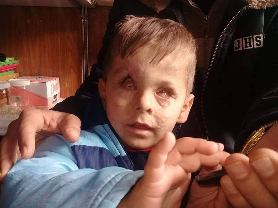 Zarokekî Efrînî bang li rêxistinên mirovî û NY dike