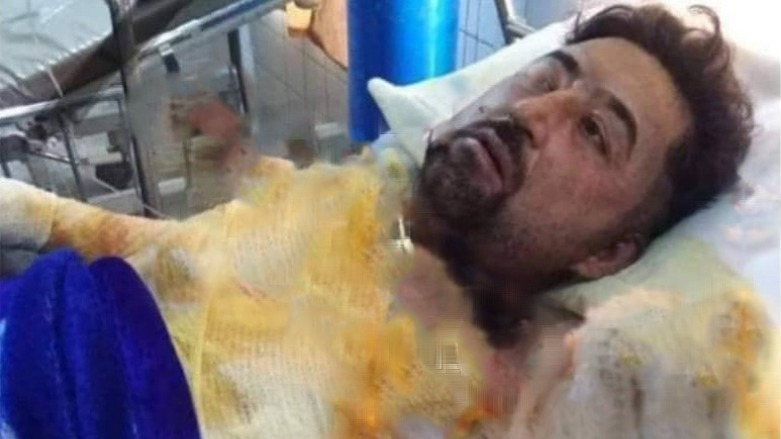 ئەو کەسەی لە رانیە ئاگری لە جەستەی خۆی بەردا گیانی لەدەستدا