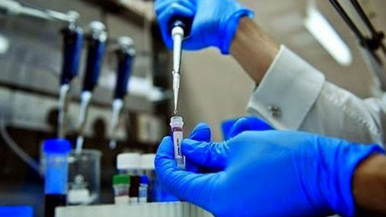 صحة كوردستان: لا اصابات بانفلونزا الخنازير في الاقليم