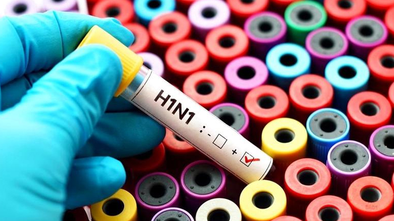 كيفية تجنب الإصابة بإنفلونزا الخنازير