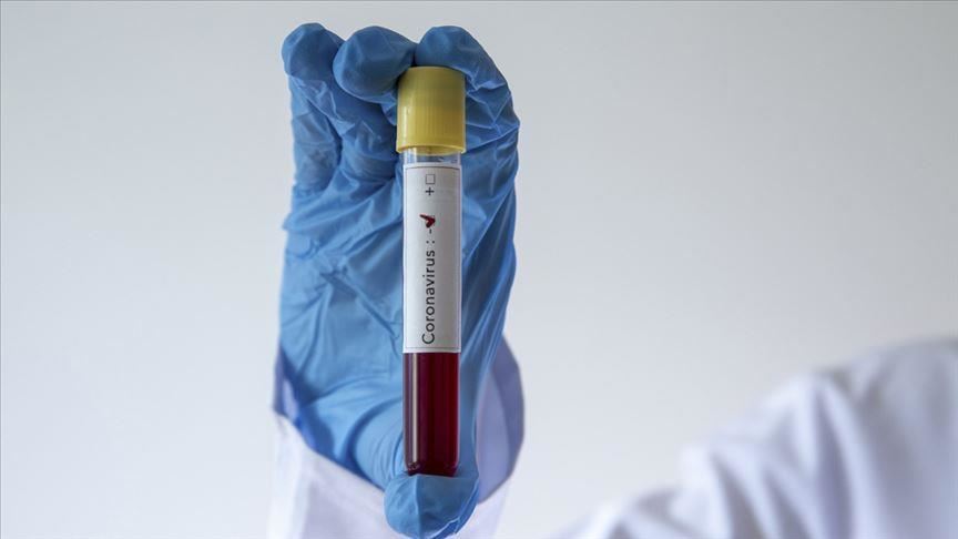 إحصاء لكوردستان 24: كورونا يرفع الإصابات في العراق الى 130