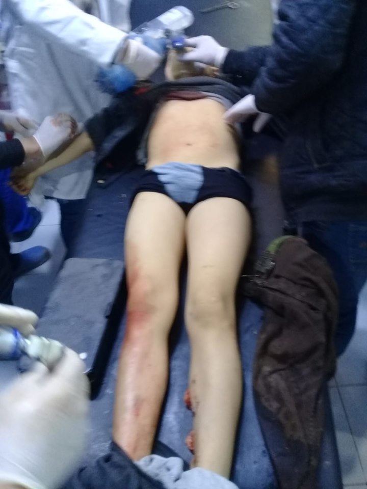 Efrîn tê topbarankirin.. Qurbanî hene