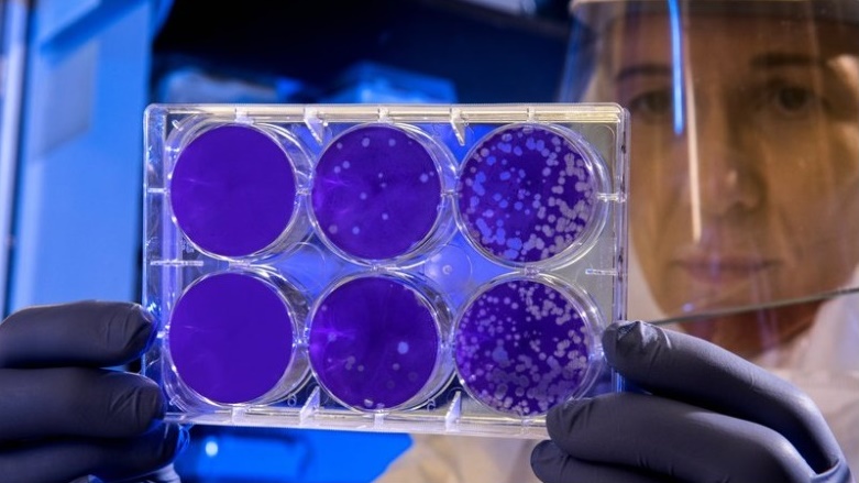 Li Tirkiyê hejmara kesên canê xwe jidest didin zêde dibe