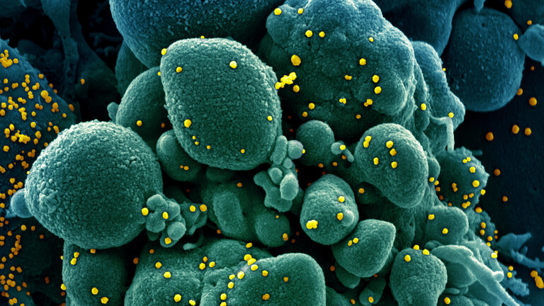 Li Îtaliya Yekem haleta çêvebûnê ji koronayê bi rê ya çareserîya Pilazma hat tomarkirin