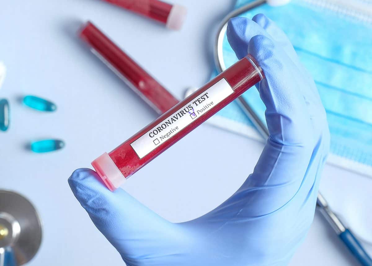 Birîtanya.. 627 kesên din bi Korona mirin