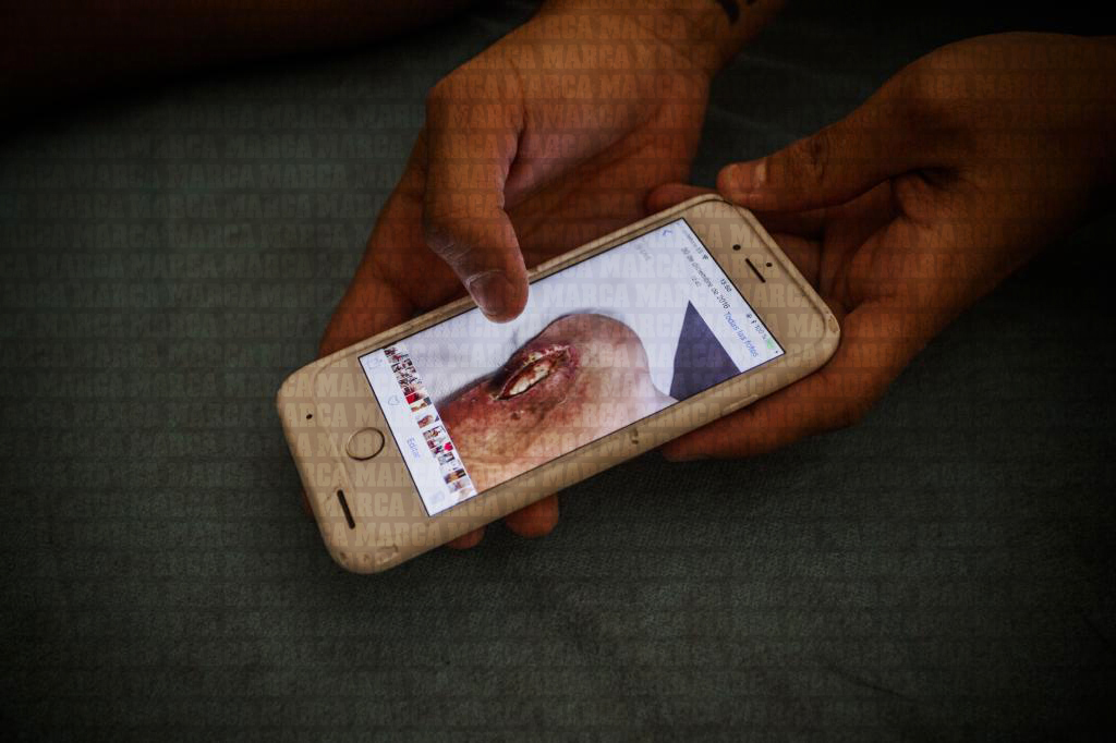 قووڵەپێی سانتی کازۆرلا