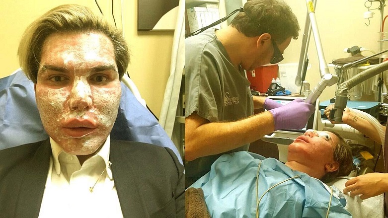 Güzellik uğruna bu hale geldi