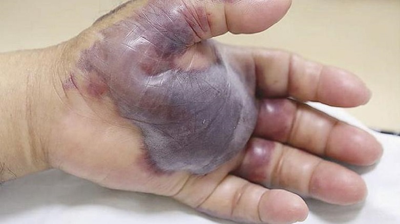 Et yedi elinden oldu 