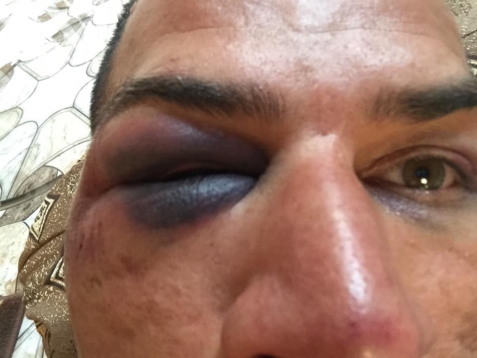 İşkence gören peşmergelerden biri